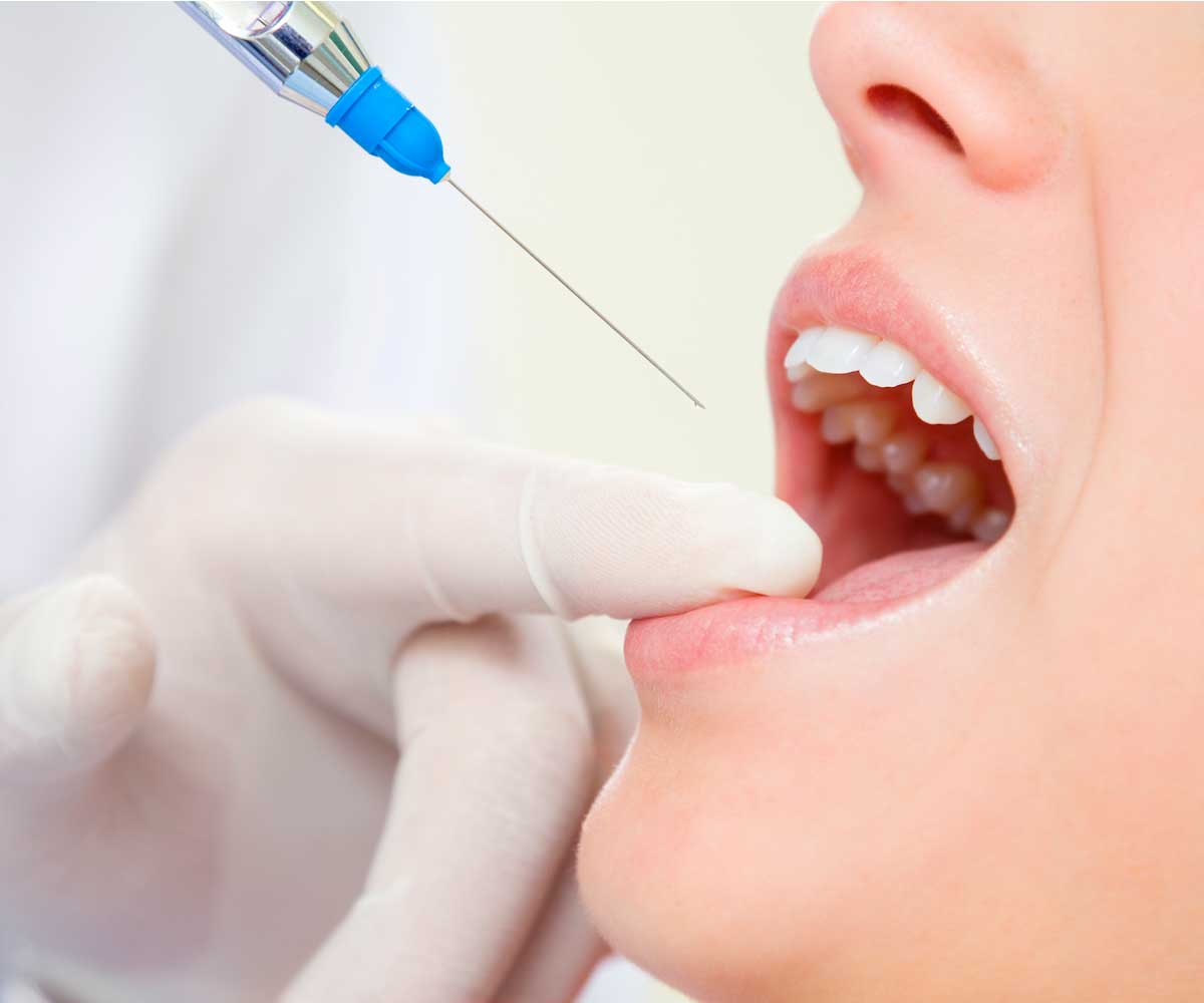 Botox Injection | Ultima Dental Wellness | SW Calgary Dentist in Kingsland