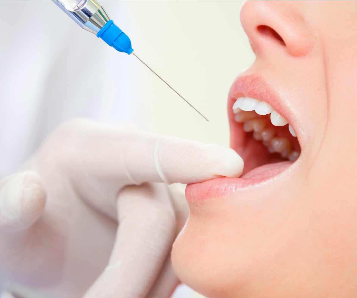 ultima-dental-wellness-botox-injection Botox Injection | Ultima Dental Wellness | SW Calgary Dentist in Kingsland