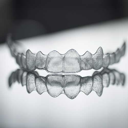 Invisalign Clear Aligners | Ultima Dental Wellness | SW Calgary Dentist in Kingsland