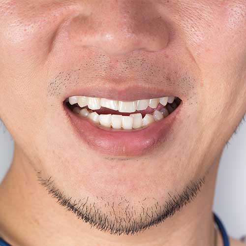 Orthodontic Dentistry | Ultima Dental Wellness | SW Calgary Dentist in Kingsland